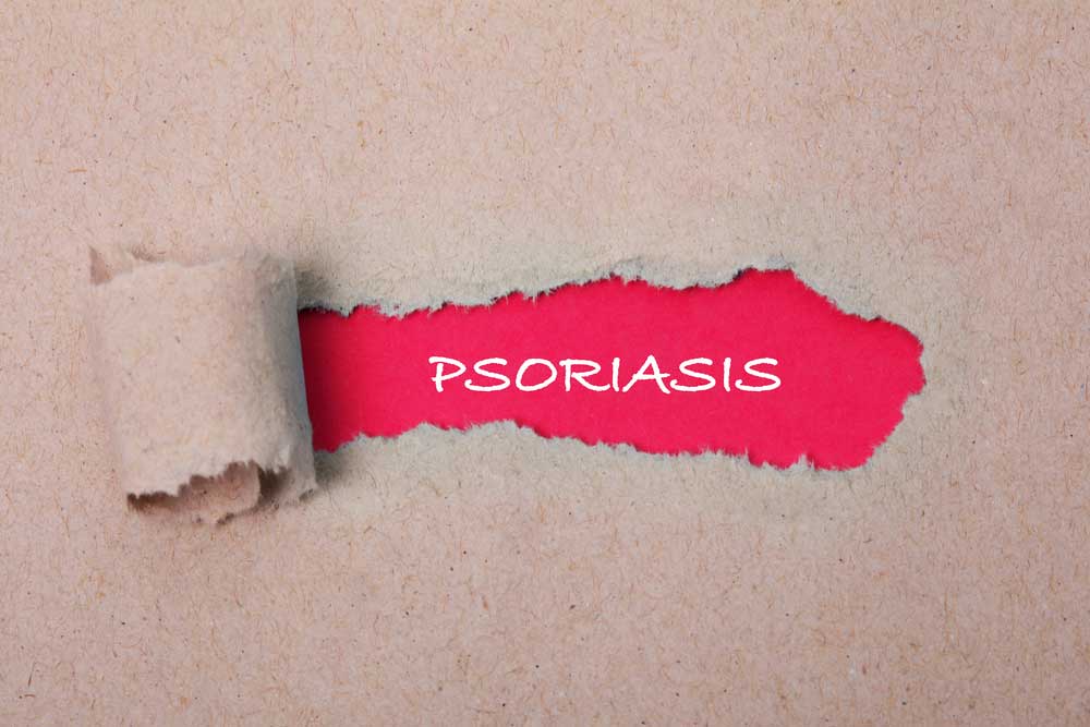 Psoriasis5.jpg