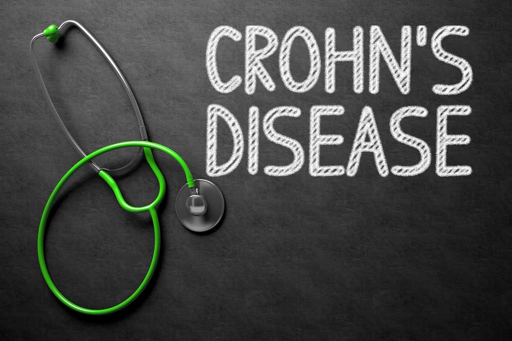 Crohns-Disease-2.jpg