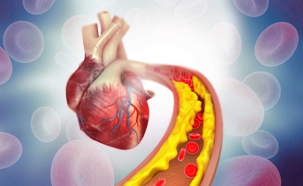 cholesterol-heart-2.jpg