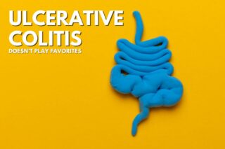 Ulcerative Colitis Doesn’t Play Favorites