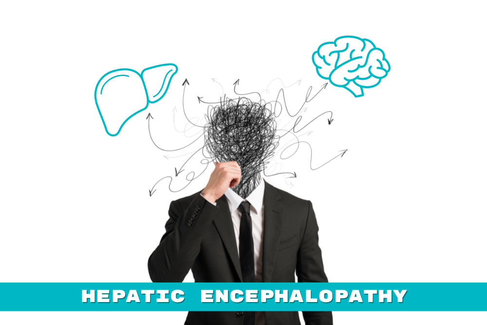 Cirrhosis-Hepatic-Encephalopathy