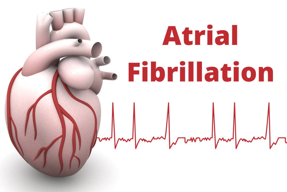 Atrial-Fibrillation.jpg