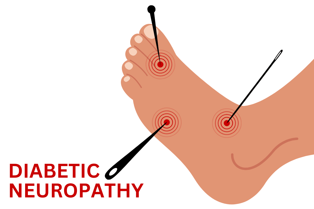 What Are the Different Types of Diabetic Neuropathy? - ENCORE Research Group