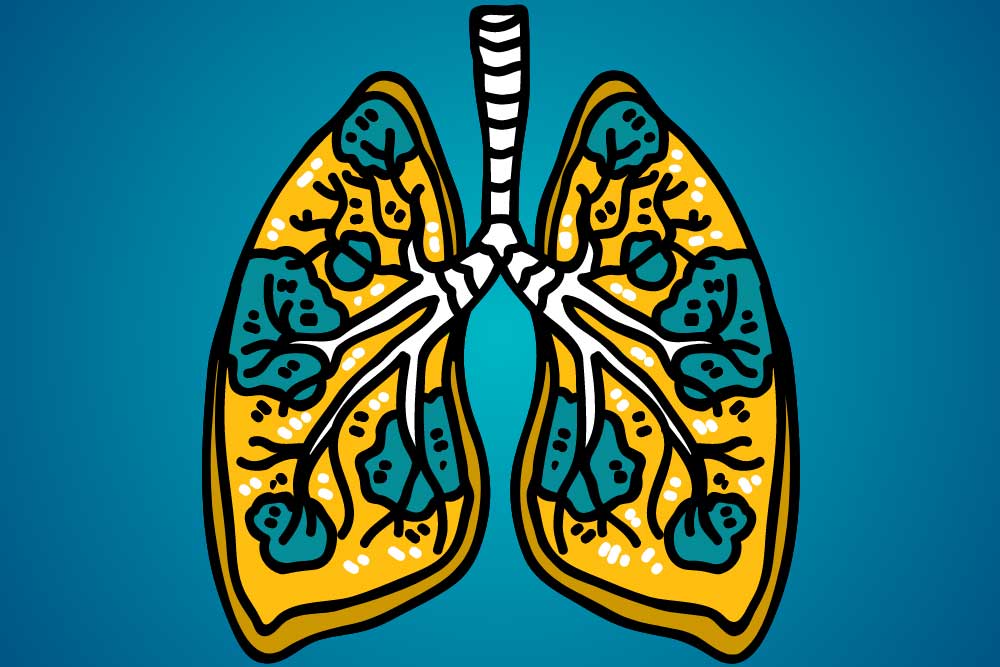 Take A Breath As We Dive Into Lung Cancer