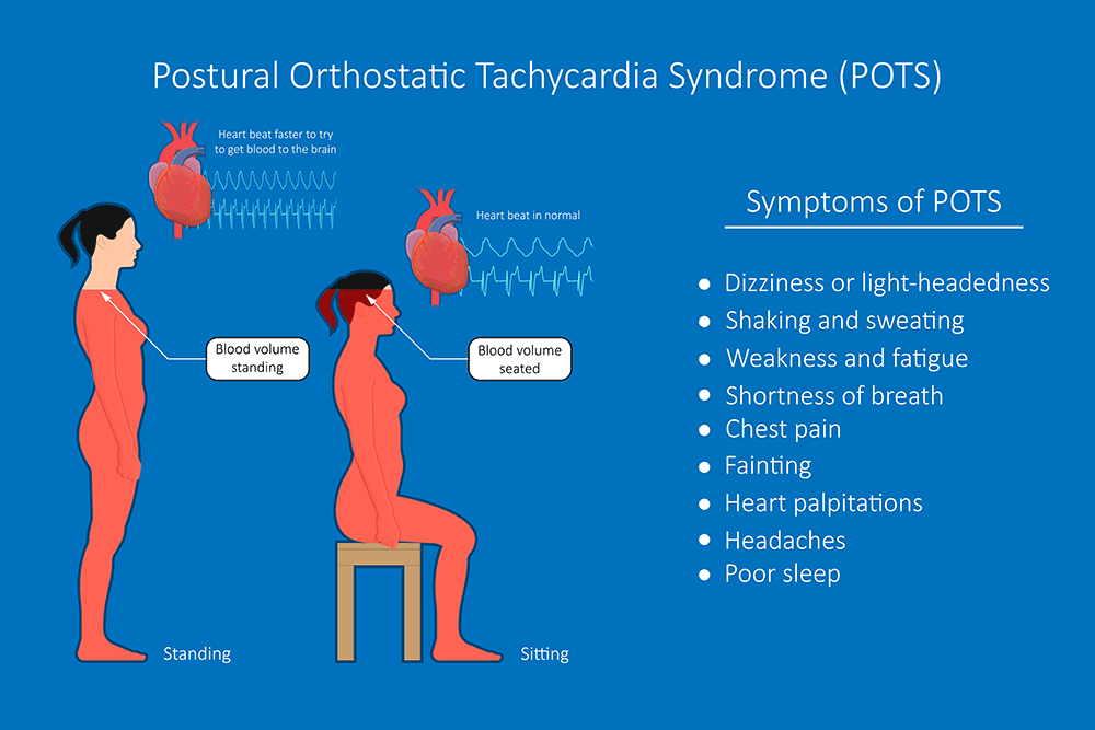 POTS-Postural-Orthostatic-Tachycardia-Syndrome.png