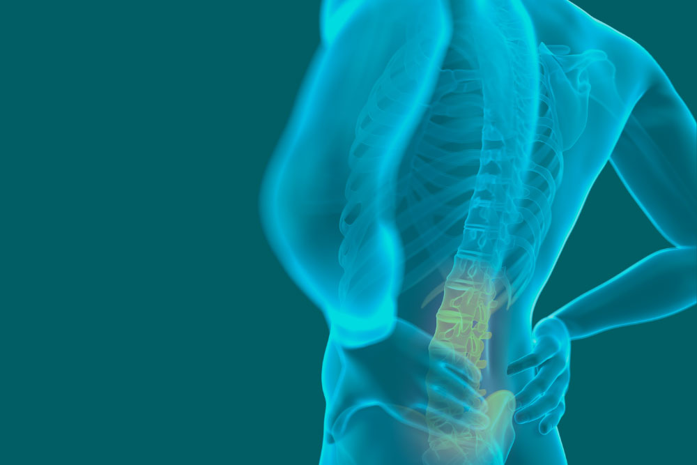 Low Back Pain: Lumbosacral Radiculopathy