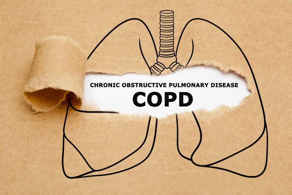 COPD.jpg