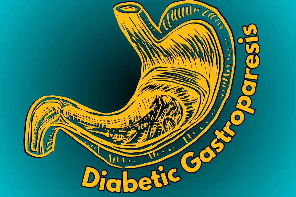 What-Is-Diabetic-Gastroparesis-and-How-Does-Diabetes-Affect-Digestion-.jpg