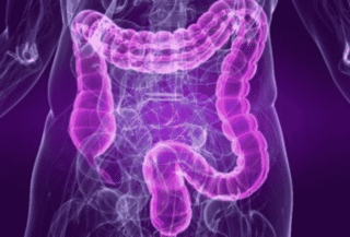 Colon Cancer Screening Test