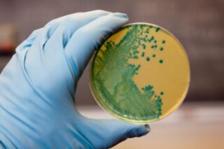Recurrent C. Diff
